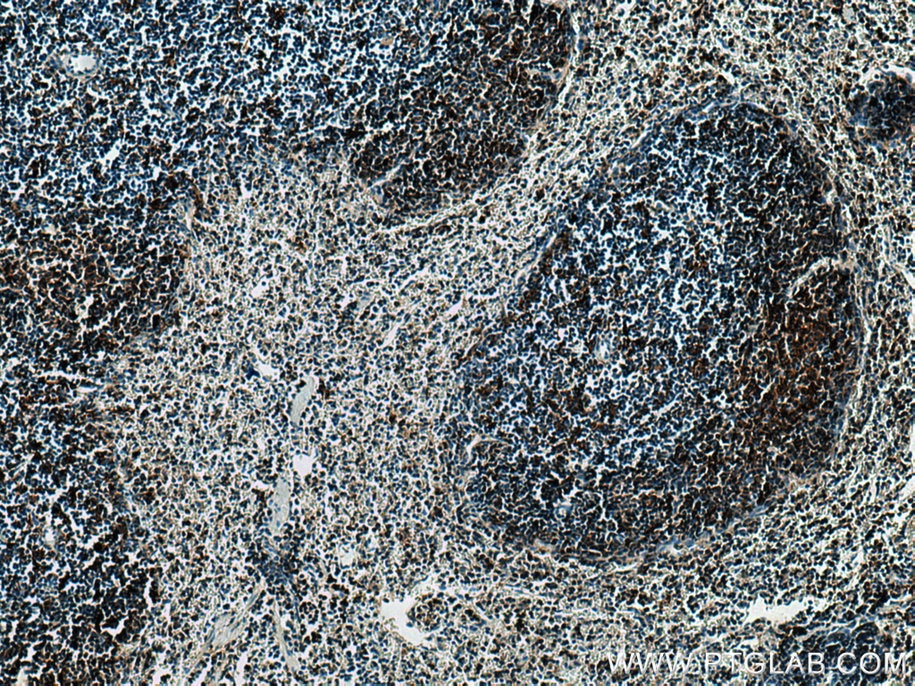 Immunohistochemistry (IHC) staining of mouse spleen tissue using p47 phox Polyclonal antibody (28187-1-AP)