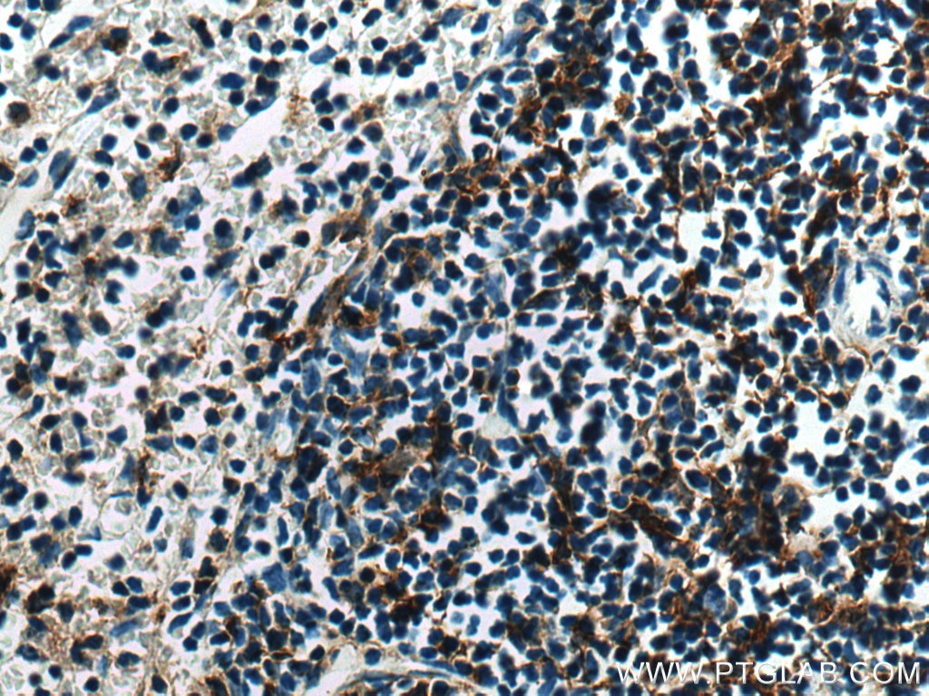 Immunohistochemistry (IHC) staining of mouse spleen tissue using p47 phox Polyclonal antibody (28187-1-AP)