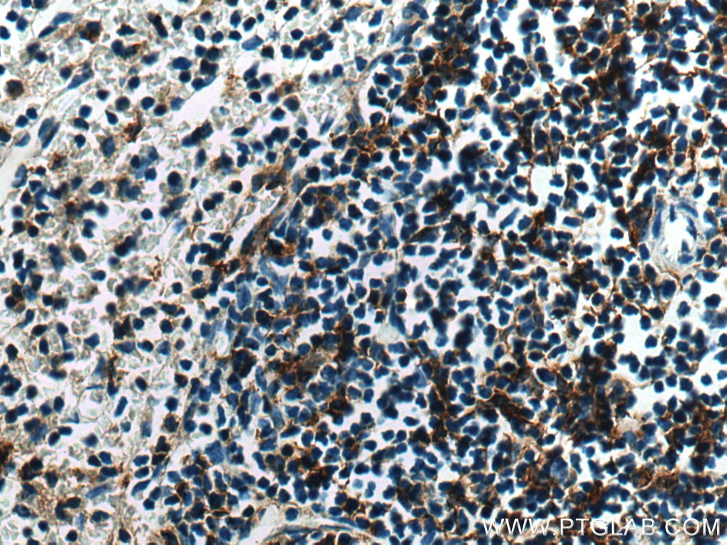 IHC staining of mouse spleen using 28187-1-AP