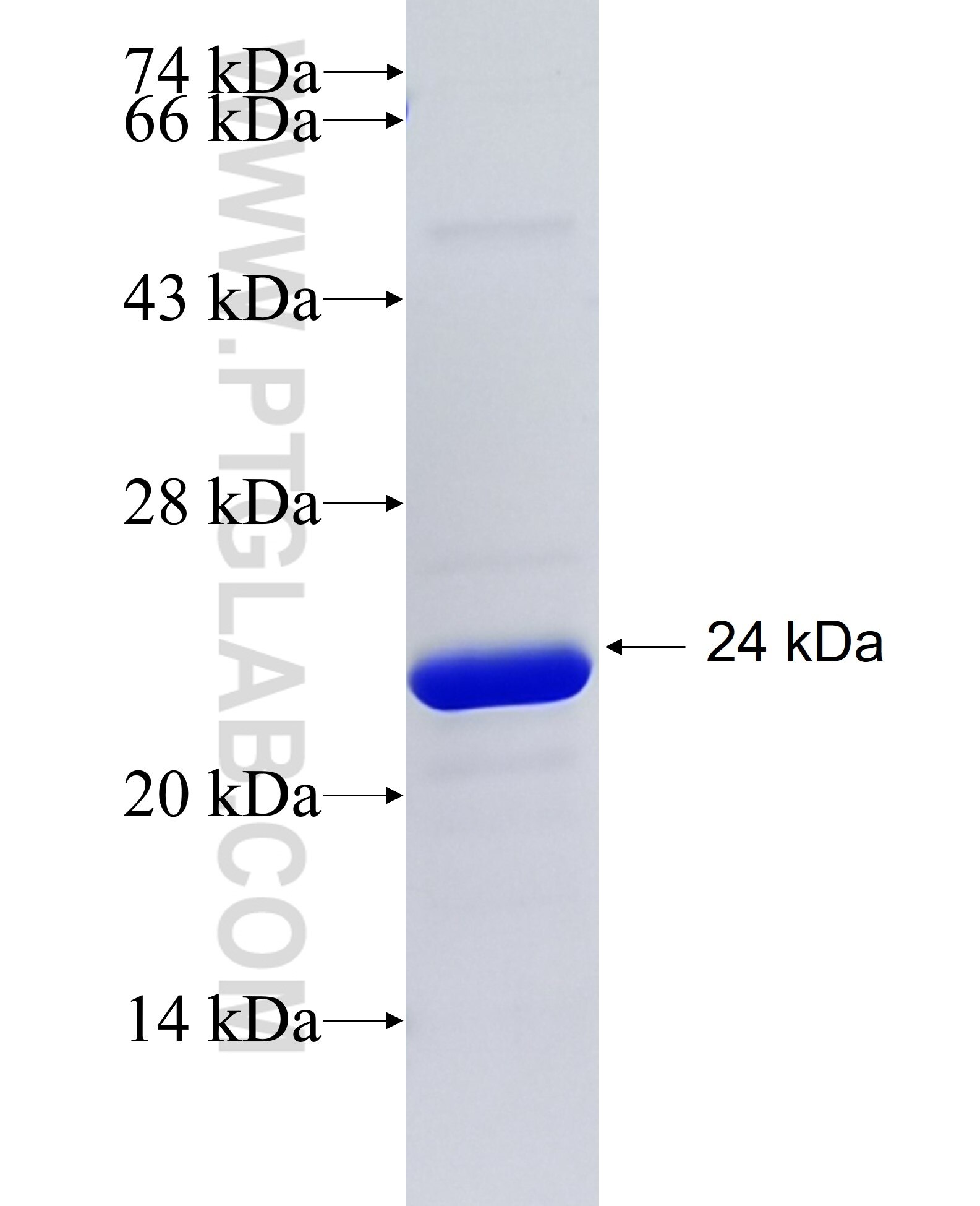 NCF1 fusion protein Ag28101 SDS-PAGE