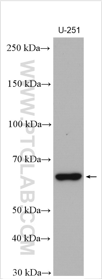 Western Blot (WB) analysis of various lysates using NOXA2/p67phox Polyclonal antibody (15551-1-AP)