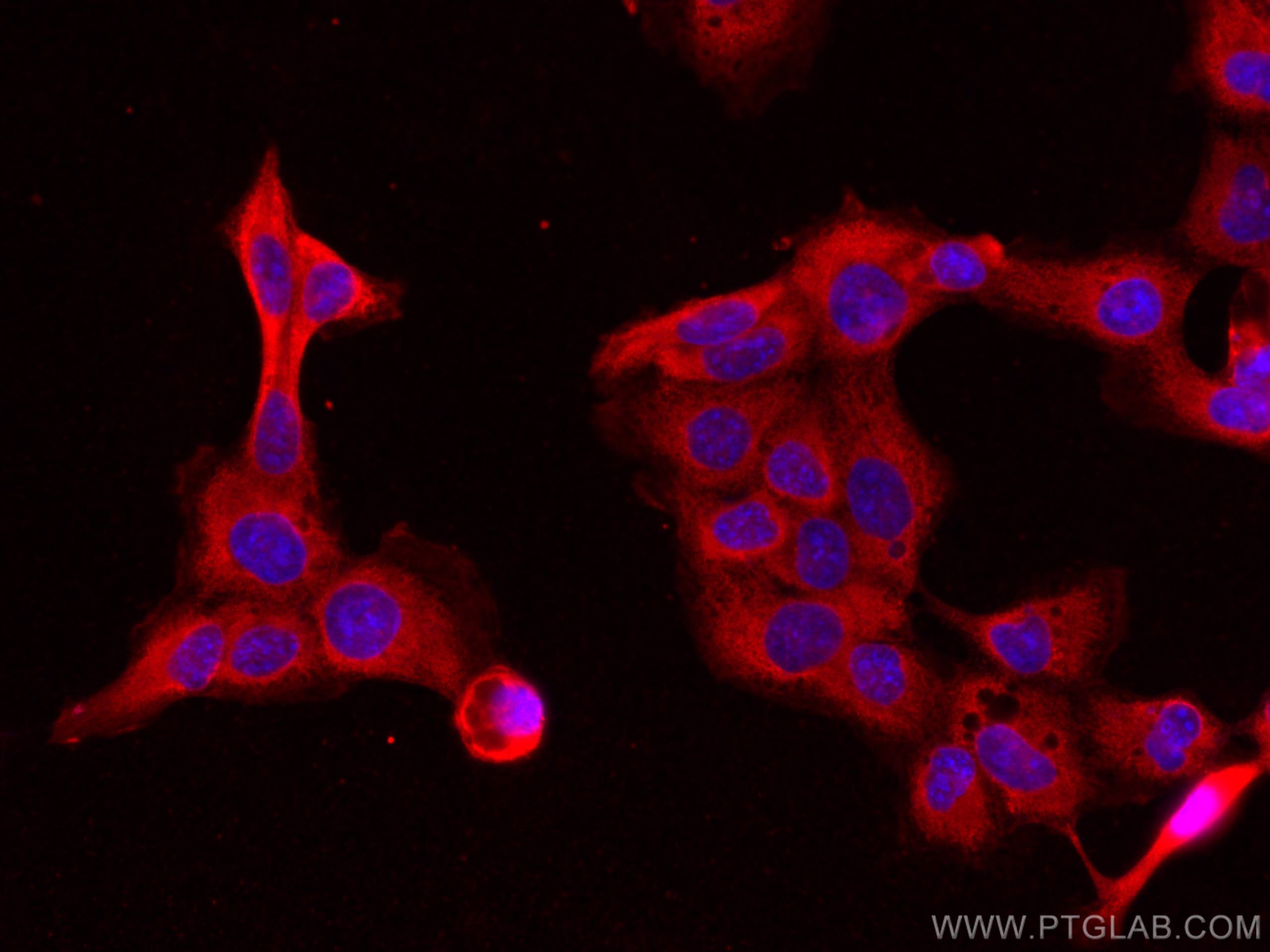 Immunofluorescence (IF) / fluorescent staining of A431 cells using NOXA2/p67phox Monoclonal antibody (67594-1-Ig)