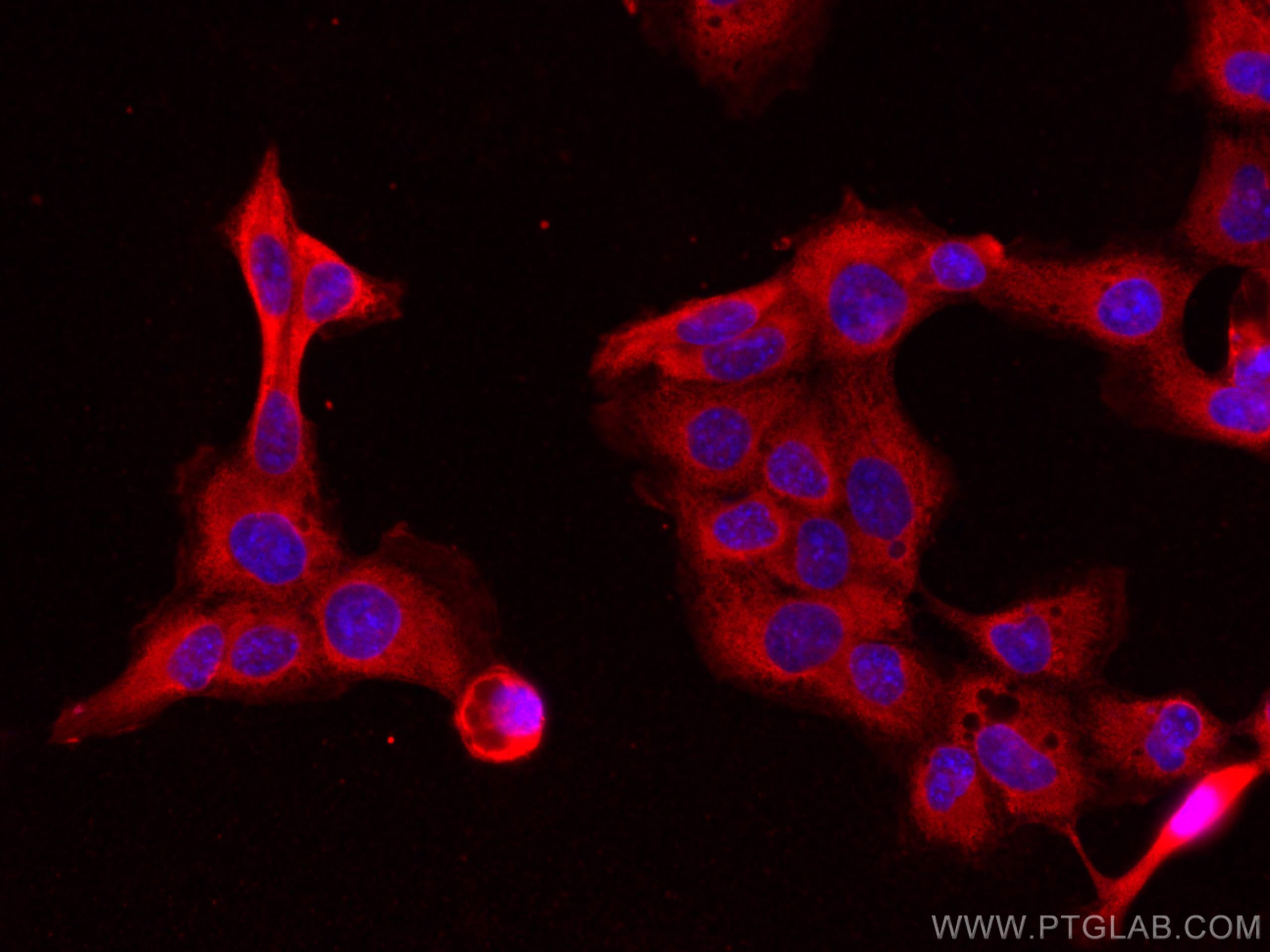 IF Staining of A431 using 67594-1-Ig