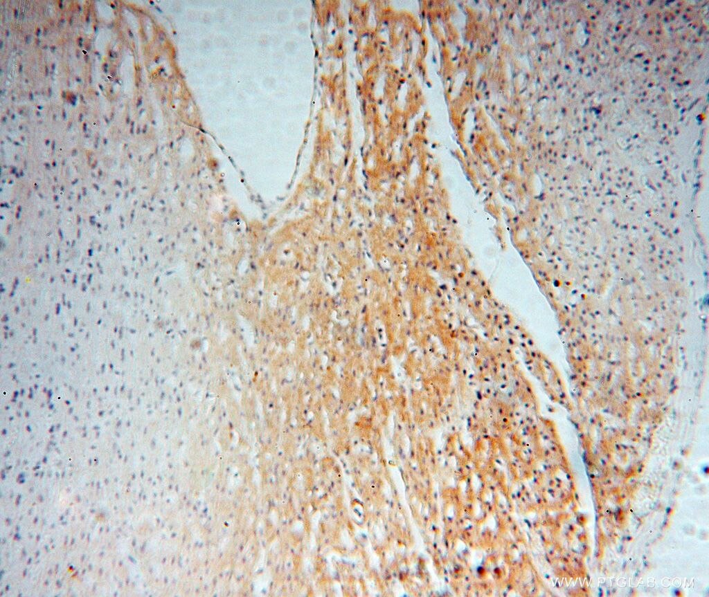 Immunohistochemistry (IHC) staining of human heart tissue using NCF4 Polyclonal antibody (14648-1-AP)