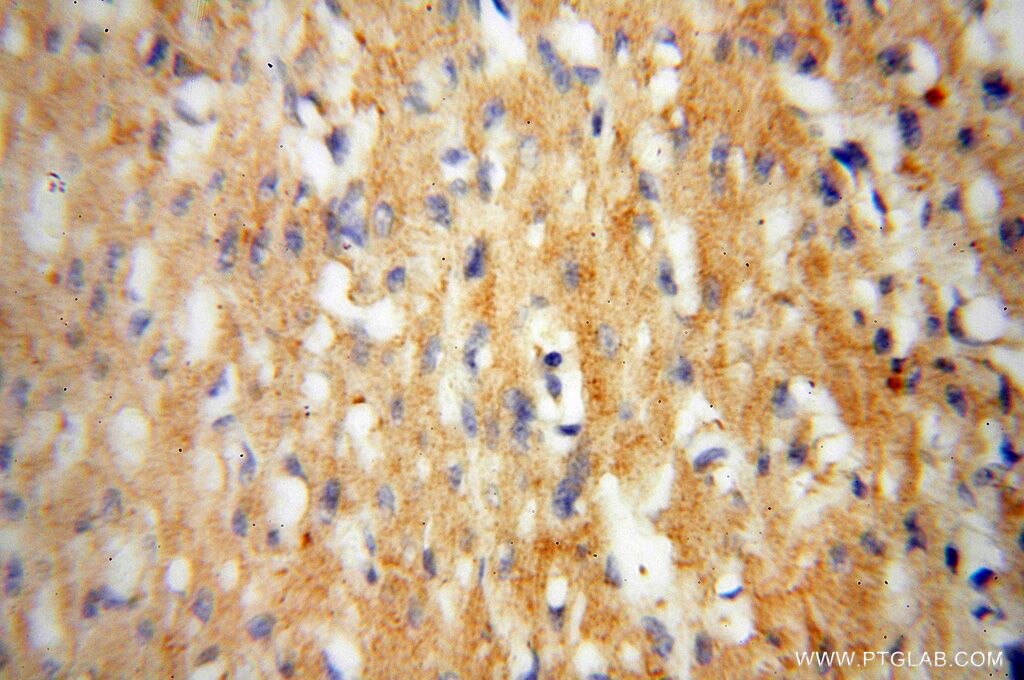 Immunohistochemistry (IHC) staining of human heart tissue using NCF4 Polyclonal antibody (14648-1-AP)