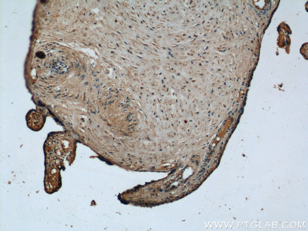 Immunohistochemistry (IHC) staining of human placenta tissue using NCF4 Polyclonal antibody (15001-1-AP)