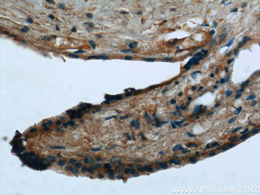 Immunohistochemistry (IHC) staining of human placenta tissue using NCF4 Polyclonal antibody (15001-1-AP)