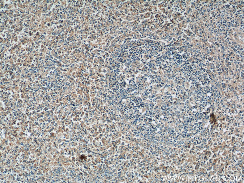 Immunohistochemistry (IHC) staining of human spleen tissue using NCF4 Polyclonal antibody (15001-1-AP)