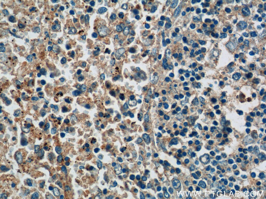 Immunohistochemistry (IHC) staining of human spleen tissue using NCF4 Polyclonal antibody (15001-1-AP)