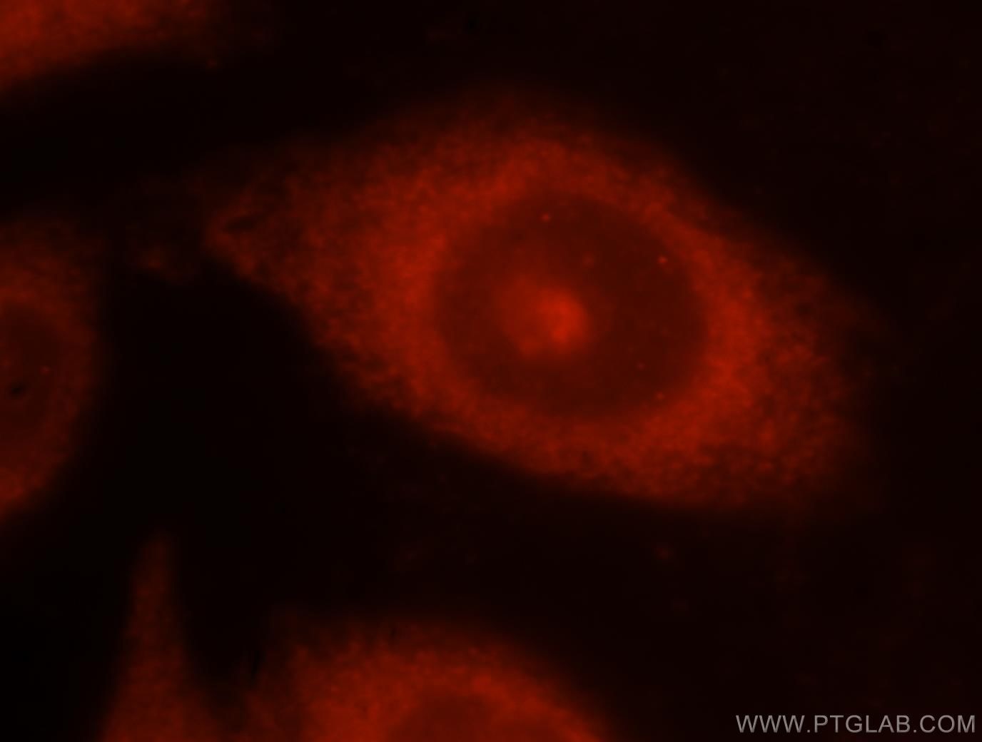 Immunofluorescence (IF) / fluorescent staining of HeLa cells using NCK1 Polyclonal antibody (15247-1-AP)