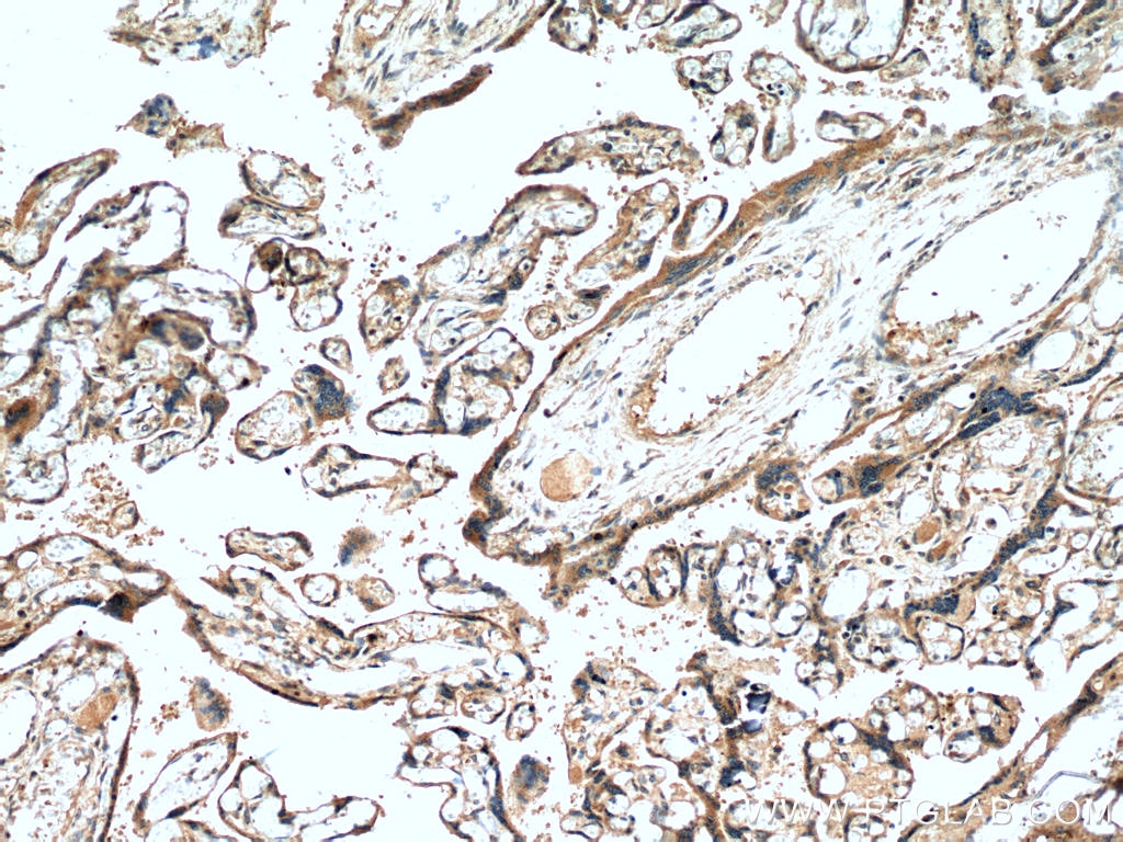 Immunohistochemistry (IHC) staining of human placenta tissue using NCK2 Polyclonal antibody (10206-1-AP)