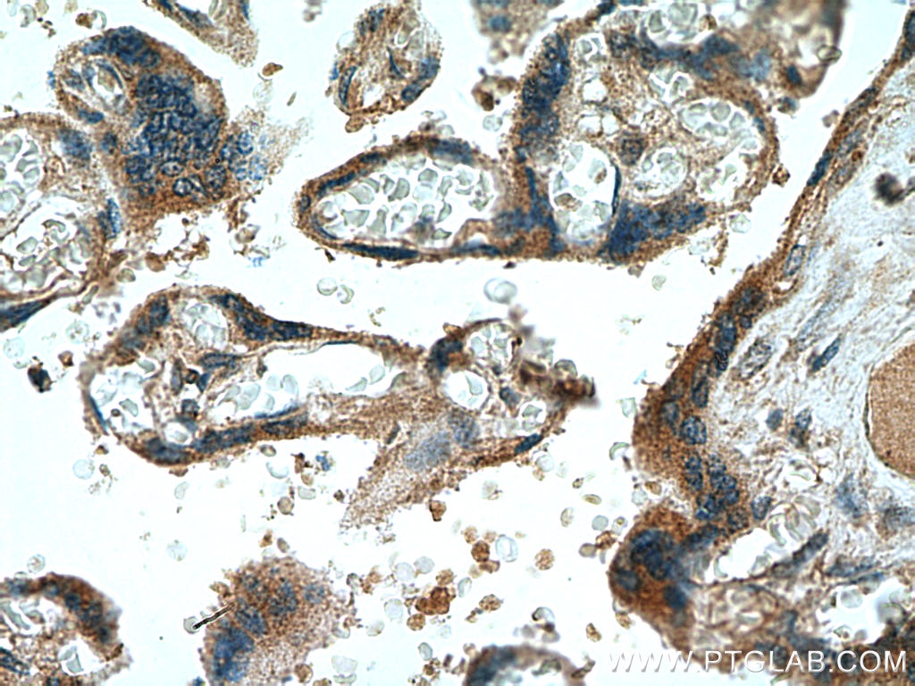Immunohistochemistry (IHC) staining of human placenta tissue using NCK2 Polyclonal antibody (10206-1-AP)