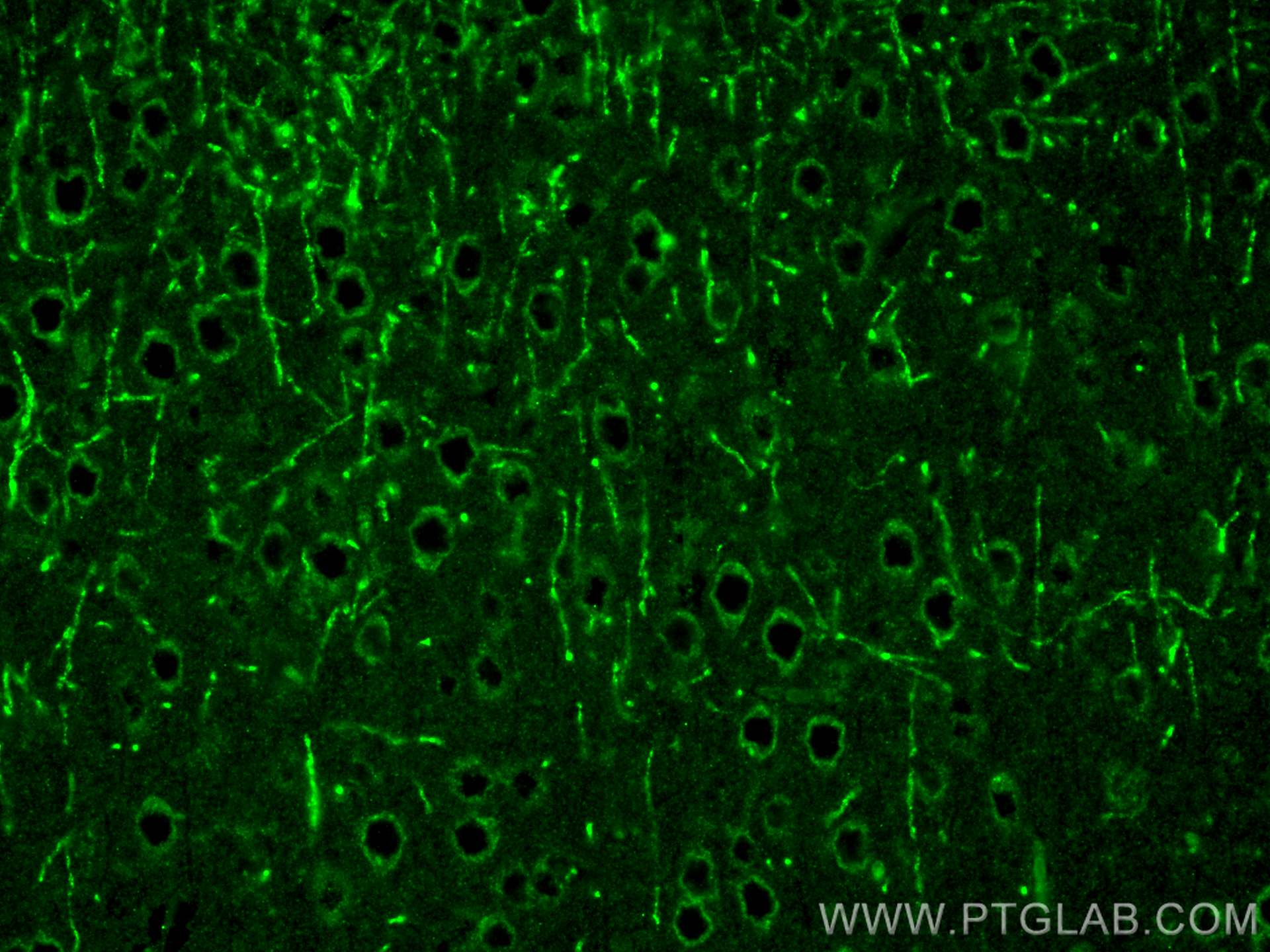 Immunofluorescence (IF) / fluorescent staining of mouse brain tissue using NCKAP1 Polyclonal antibody (12140-1-AP)