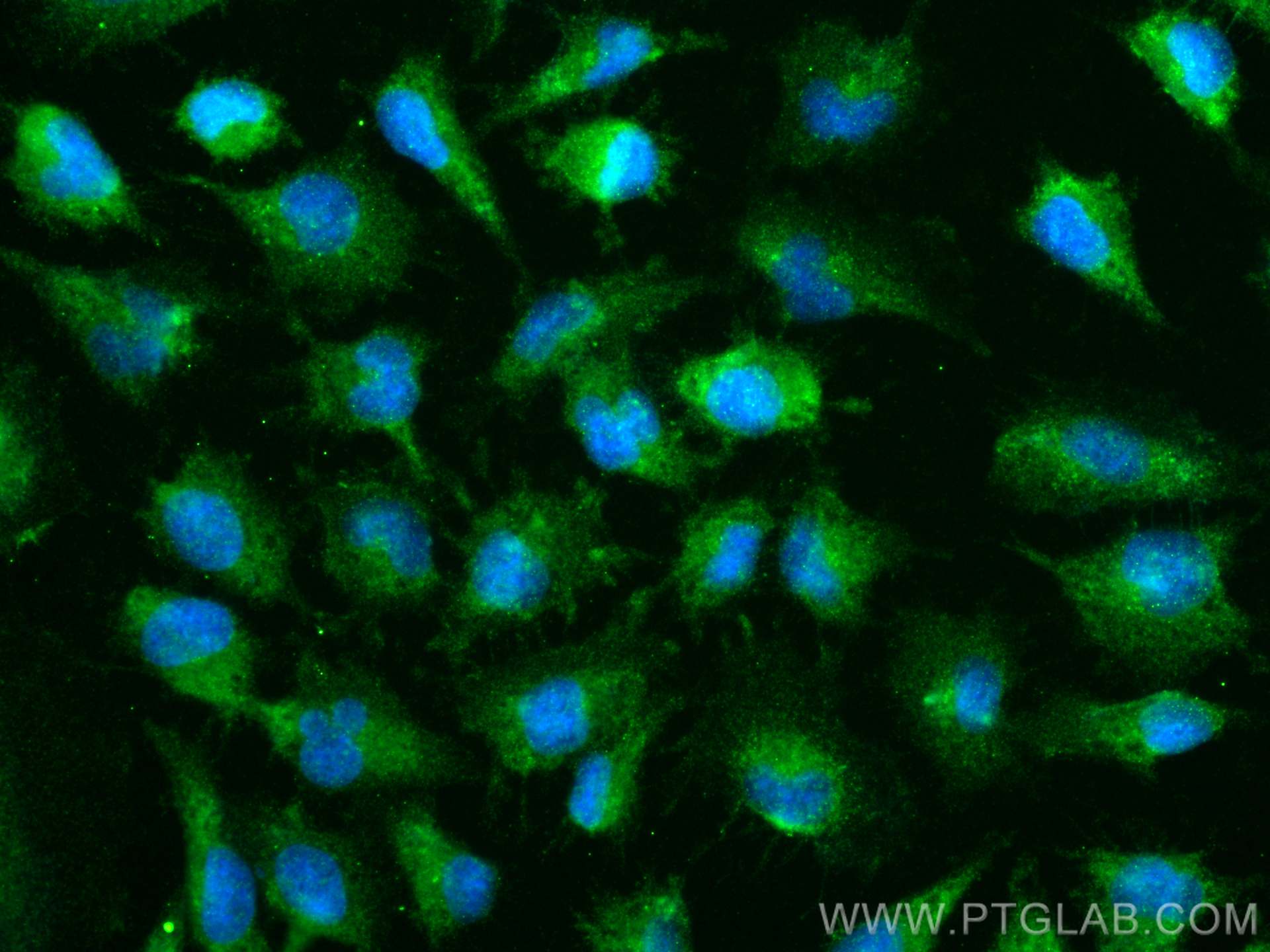 Immunofluorescence (IF) / fluorescent staining of U-251 cells using NCKAP1 Polyclonal antibody (12140-1-AP)