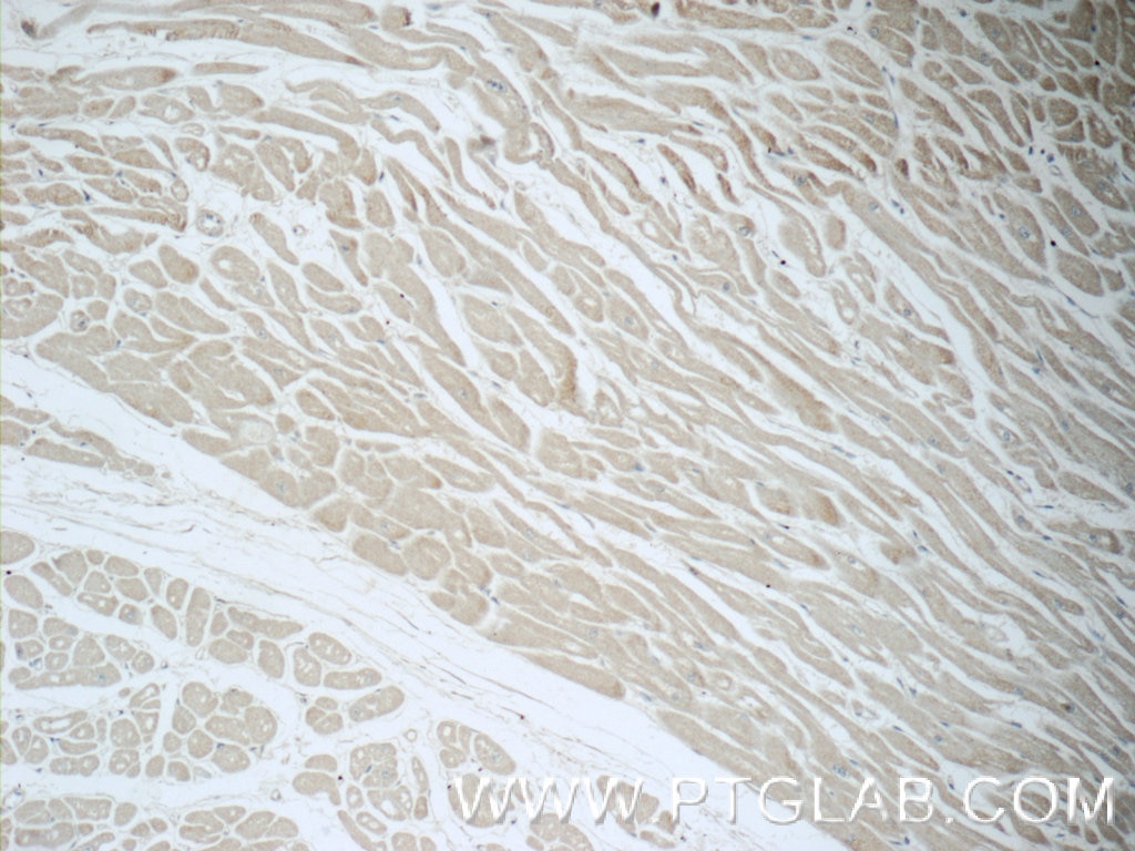 Immunohistochemistry (IHC) staining of human heart tissue using NCKAP1 Polyclonal antibody (12140-1-AP)