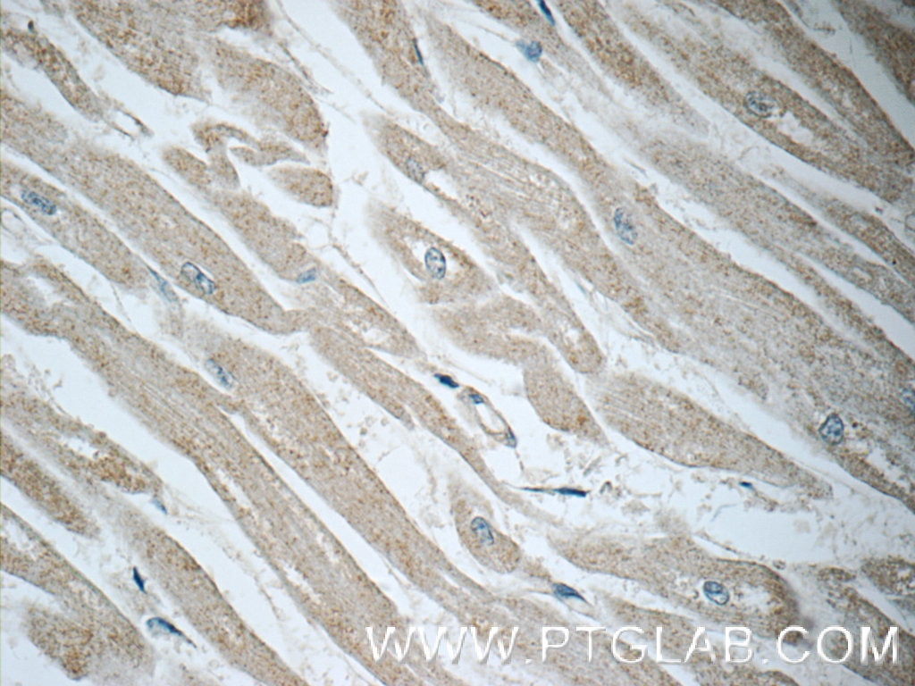 Immunohistochemistry (IHC) staining of human heart tissue using NCKAP1 Polyclonal antibody (12140-1-AP)