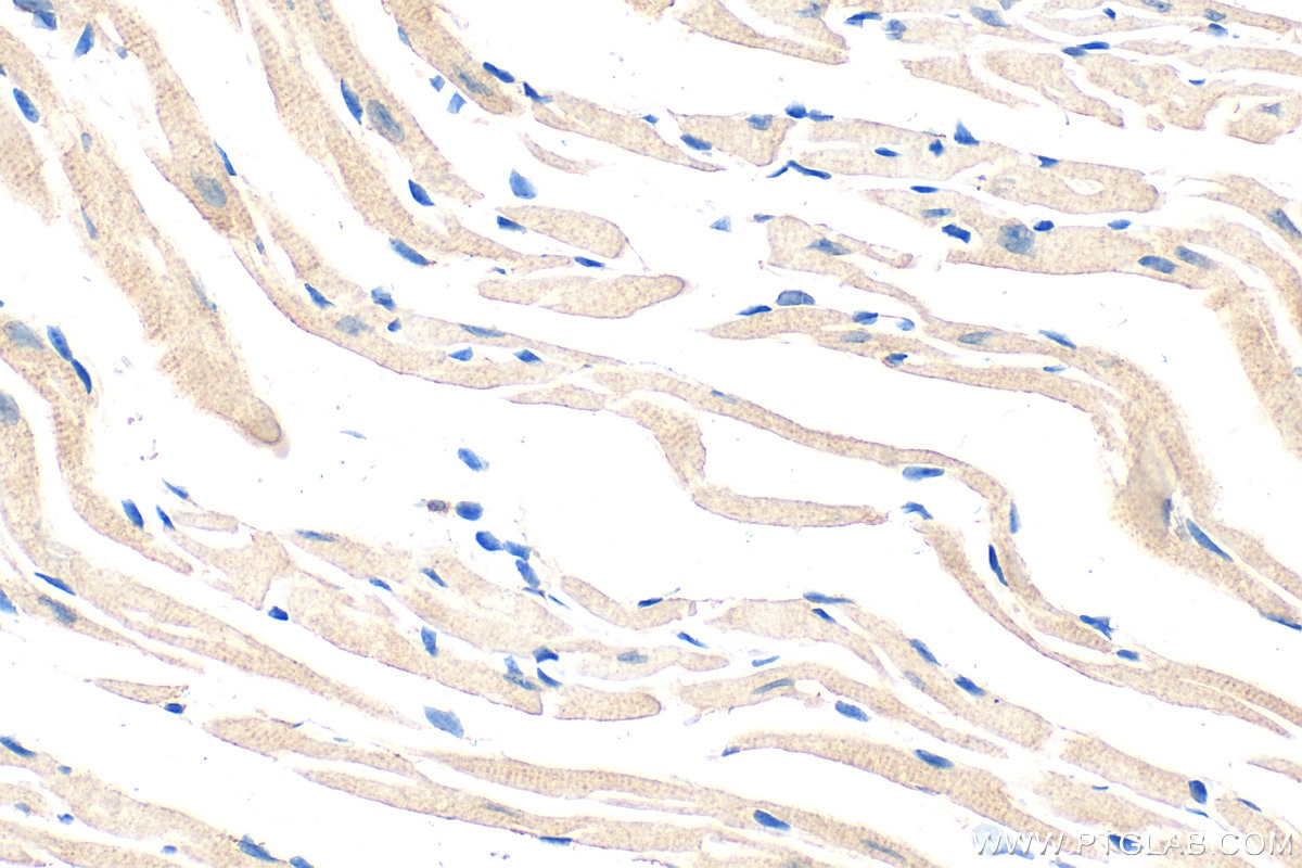 Immunohistochemical analysis of paraffin-embedded mouse heart tissue slide using 12140-1-AP (NCKAP1 antibody) at dilution of 1:200 (under 40x lens). Heat mediated antigen retrieval with Tris-EDTA buffer (pH 9.0). Immunohistochemistry (IHC) staining of mouse heart tissue using NCKAP1 Polyclonal antibody (12140-1-AP)
