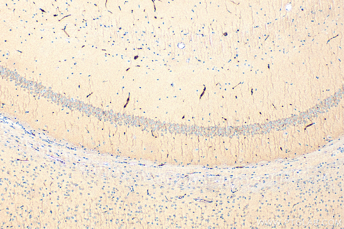 Immunohistochemical analysis of paraffin-embedded mouse brain tissue slide using 12140-1-AP (NCKAP1 antibody) at dilution of 1:200 (under 10x lens). Heat mediated antigen retrieval with Tris-EDTA buffer (pH 9.0). Immunohistochemistry (IHC) staining of mouse brain tissue using NCKAP1 Polyclonal antibody (12140-1-AP)