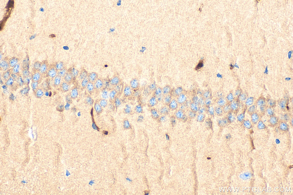 Immunohistochemical analysis of paraffin-embedded mouse brain tissue slide using 12140-1-AP (NCKAP1 antibody) at dilution of 1:200 (under 40x lens). Heat mediated antigen retrieval with Tris-EDTA buffer (pH 9.0). Immunohistochemistry (IHC) staining of mouse brain tissue using NCKAP1 Polyclonal antibody (12140-1-AP)