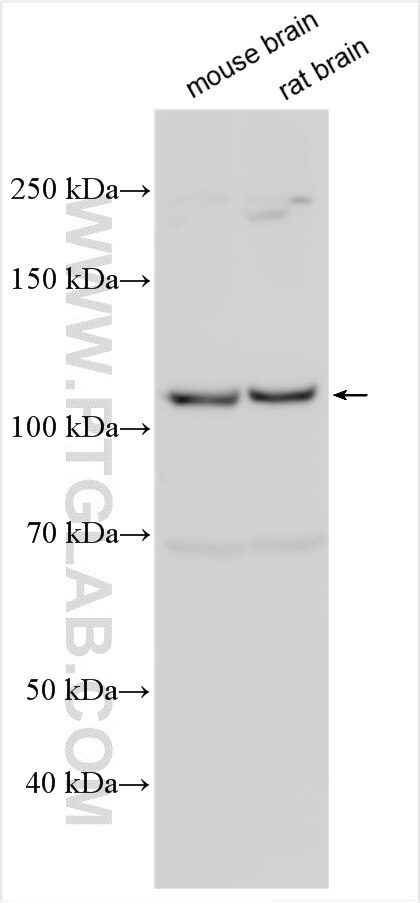 WB analysis using 12140-1-AP