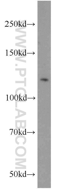 Western Blot (WB) analysis of mouse brain tissue using NCKAP1 Polyclonal antibody (12140-1-AP)