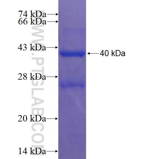 HEM1; NCKAP1L fusion protein Ag0706 SDS-PAGE