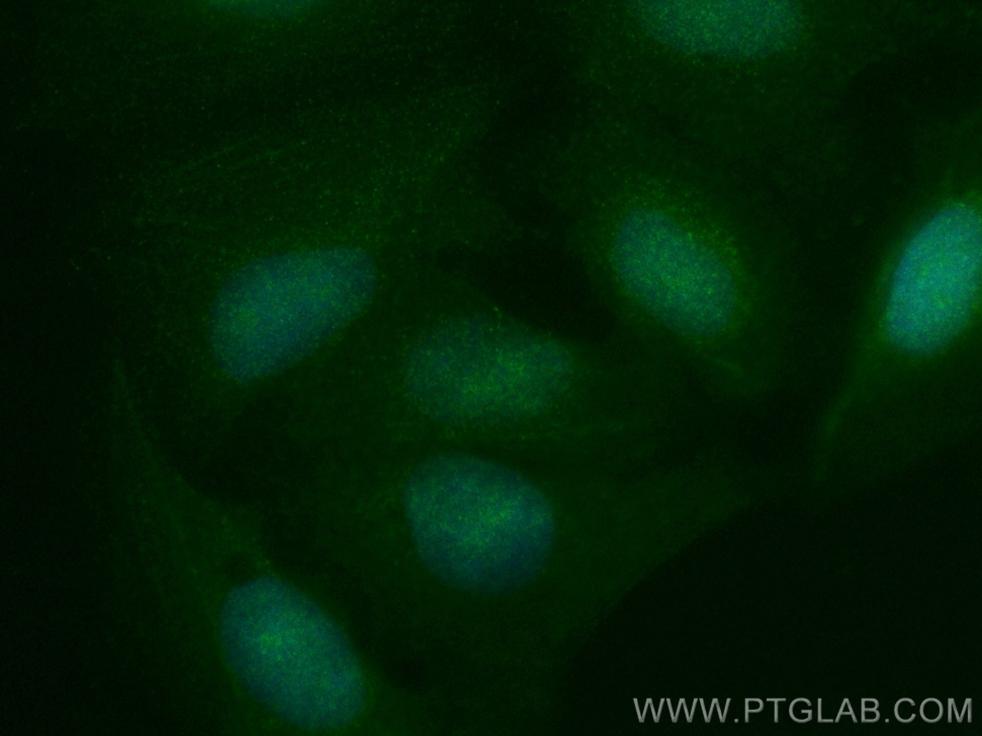 Immunofluorescence (IF) / fluorescent staining of U2OS cells using NCKAP5 Polyclonal antibody (31199-1-AP)