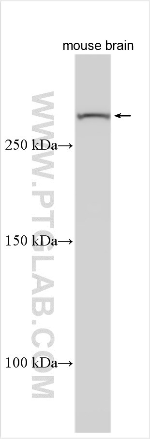 Western Blot (WB) analysis of various lysates using NCKAP5 Polyclonal antibody (31199-1-AP)