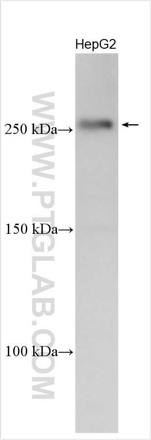 Western Blot (WB) analysis of various lysates using NCKAP5 Polyclonal antibody (31199-1-AP)