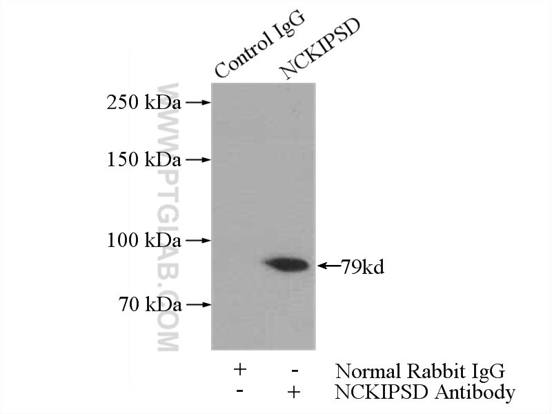 Immunoprecipitation (IP) experiment of mouse brain tissue using NCKIPSD Polyclonal antibody (11367-1-AP)
