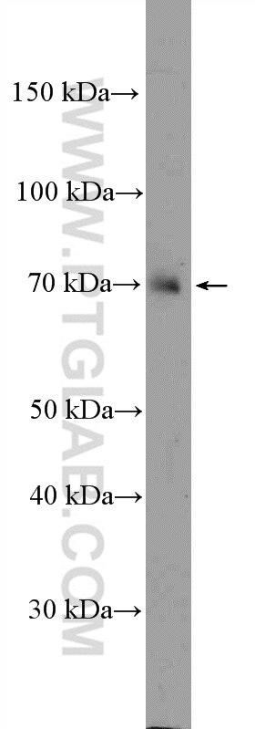 Western Blot (WB) analysis of fetal human brain tissue using NCKIPSD Polyclonal antibody (11367-1-AP)