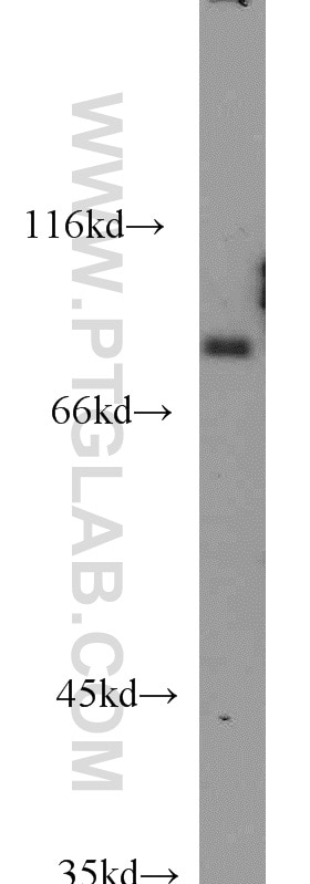 Western Blot (WB) analysis of human heart tissue using NCKIPSD Polyclonal antibody (11367-1-AP)
