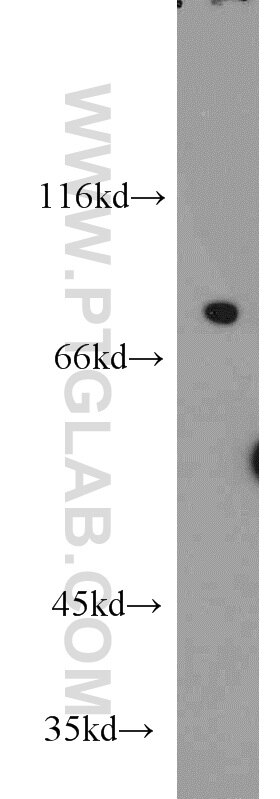 Western Blot (WB) analysis of mouse brain tissue using NCKIPSD Polyclonal antibody (11367-1-AP)