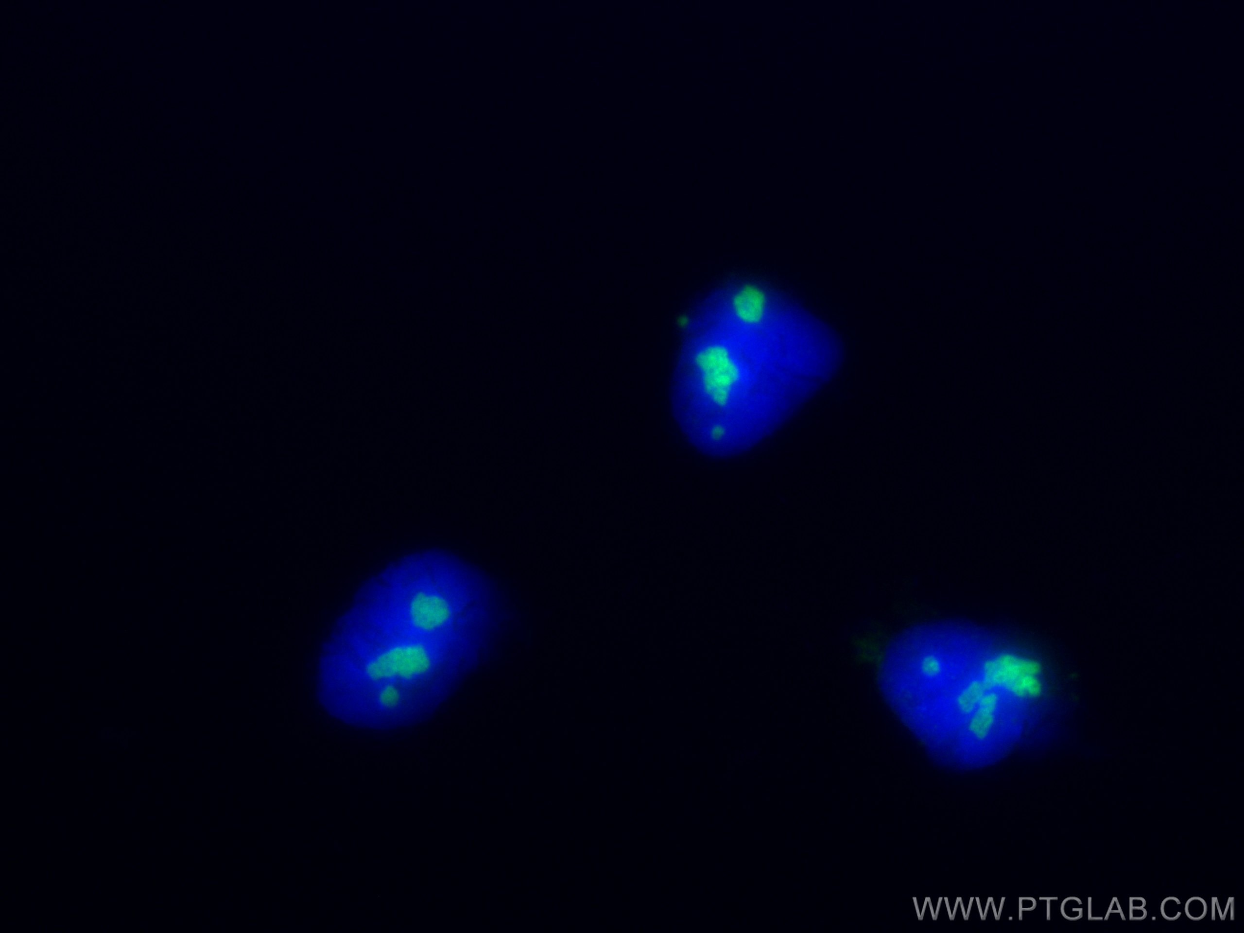 IF Staining of HEK-293 using 10556-1-AP