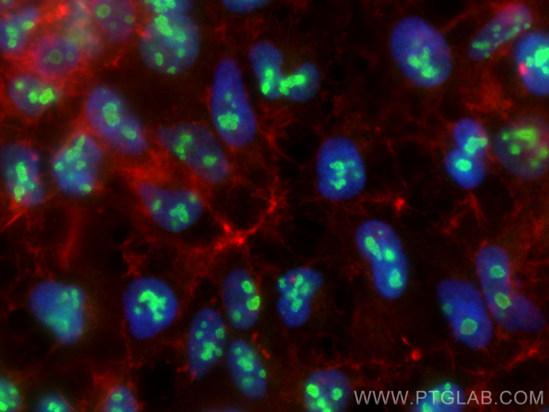 Immunofluorescence (IF) / fluorescent staining of HEK-293 cells using NCL Polyclonal antibody (10556-1-AP)