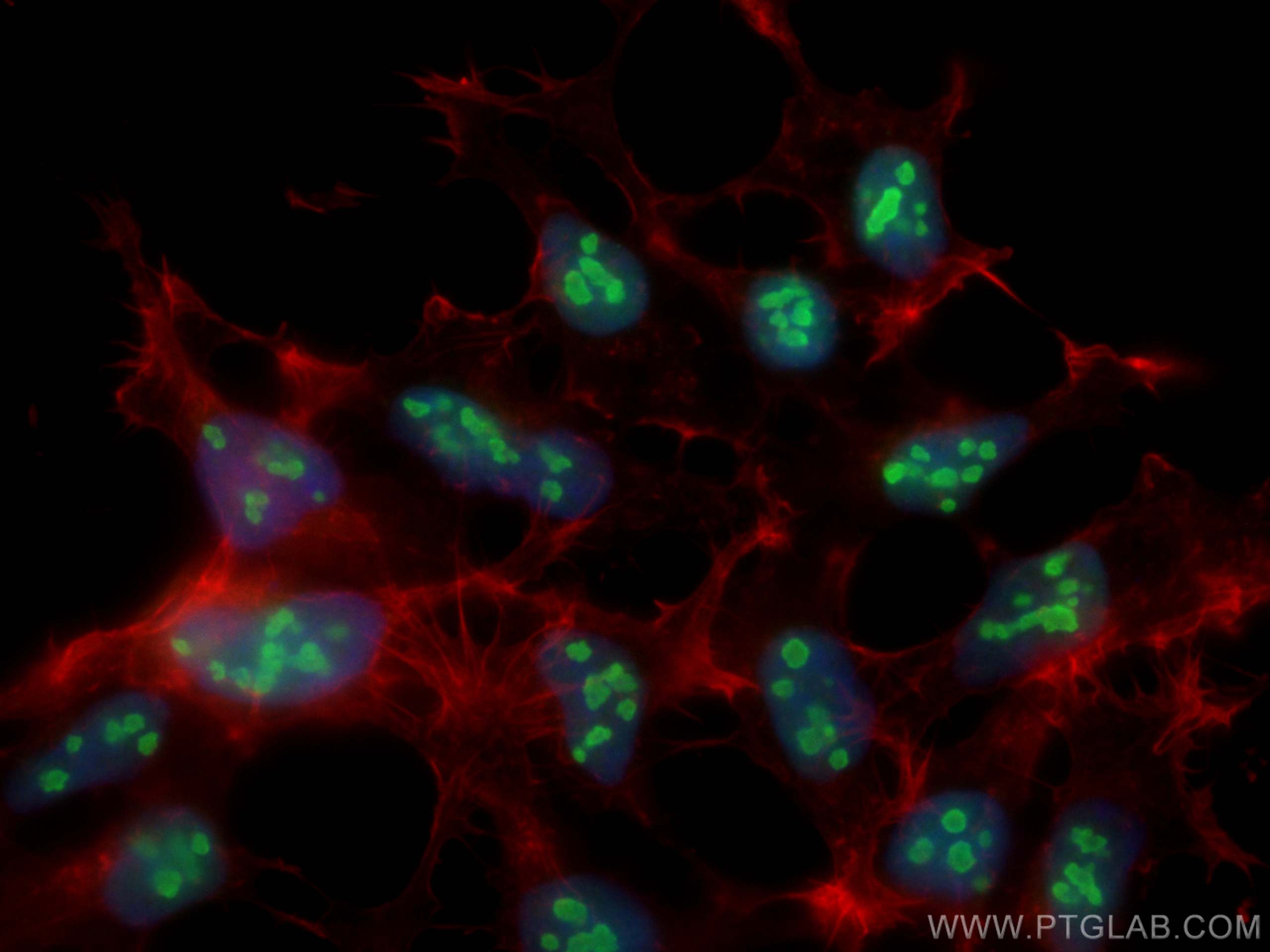 Immunofluorescence (IF) / fluorescent staining of HEK-293 cells using NCL Polyclonal antibody (10556-1-AP)