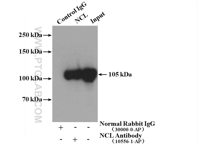 Immunoprecipitation (IP) experiment of HeLa cells using NCL Polyclonal antibody (10556-1-AP)