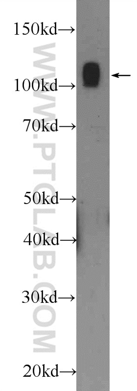 Western Blot (WB) analysis of rat brain tissue using NCL Polyclonal antibody (10556-1-AP)