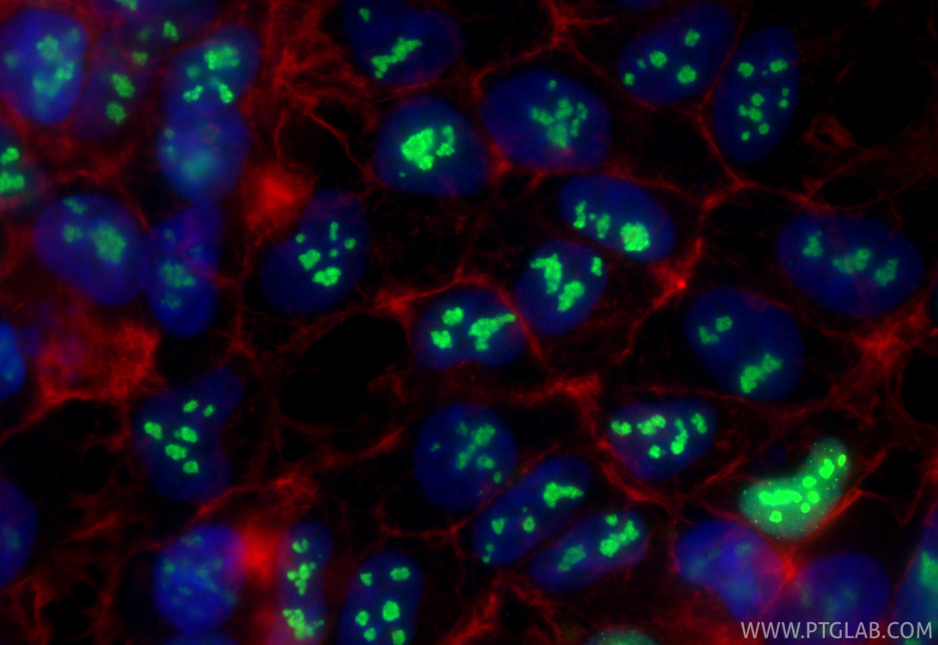 IF Staining of HEK-293 using 83380-1-RR Immunofluorescence (IF) / fluorescent staining of HEK-293 cells using Nucleolin/C23 Recombinant monoclonal antibody (83380-1-RR)