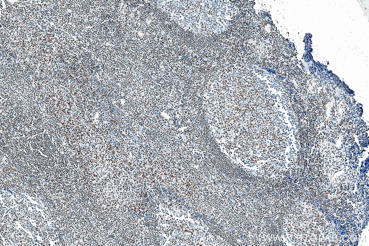 Immunohistochemistry (IHC) staining of human tonsil tissue using Nucleolin/C23 Recombinant monoclonal antibody (83380-1-RR)