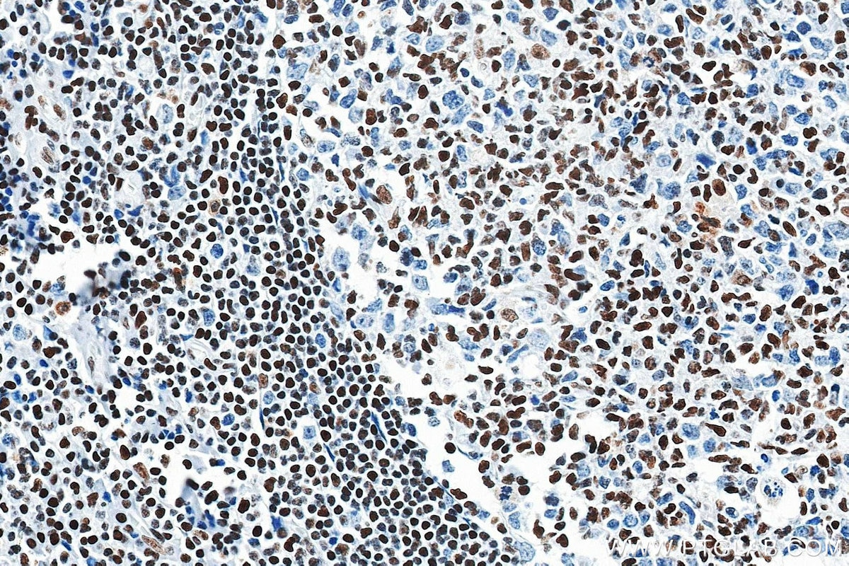 Immunohistochemistry (IHC) staining of human tonsil tissue using Nucleolin/C23 Recombinant monoclonal antibody (83380-1-RR)