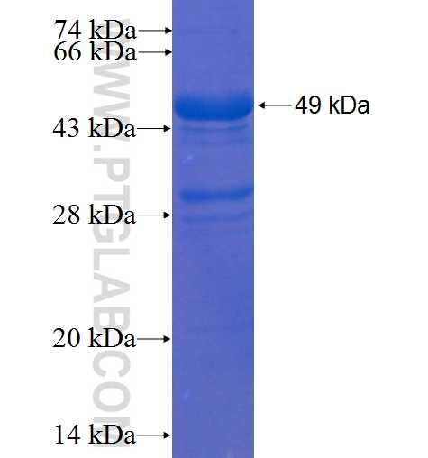NCL fusion protein Ag0859 SDS-PAGE