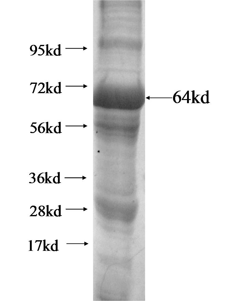 NCLN fusion protein Ag13318 SDS-PAGE