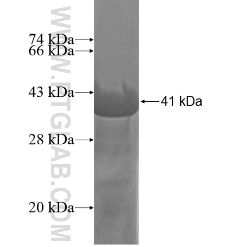 NCLN fusion protein Ag13362 SDS-PAGE