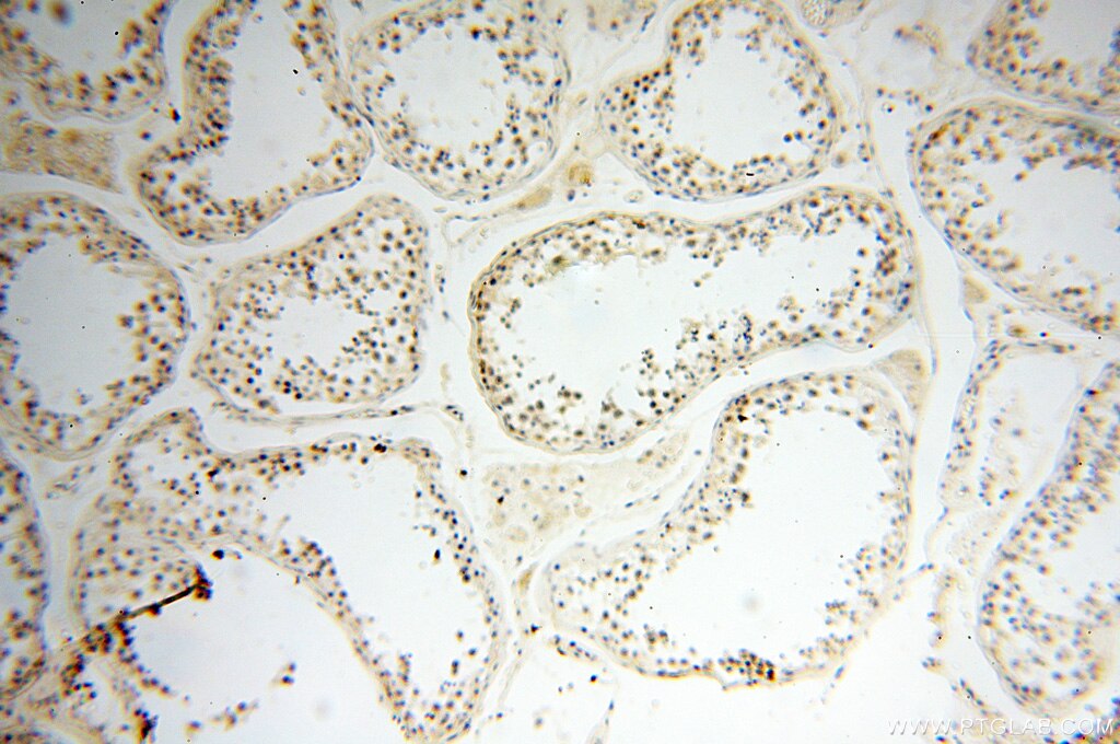 Immunohistochemistry (IHC) staining of human testis tissue using NCOA1/SRC-1 Polyclonal antibody (51114-1-AP)