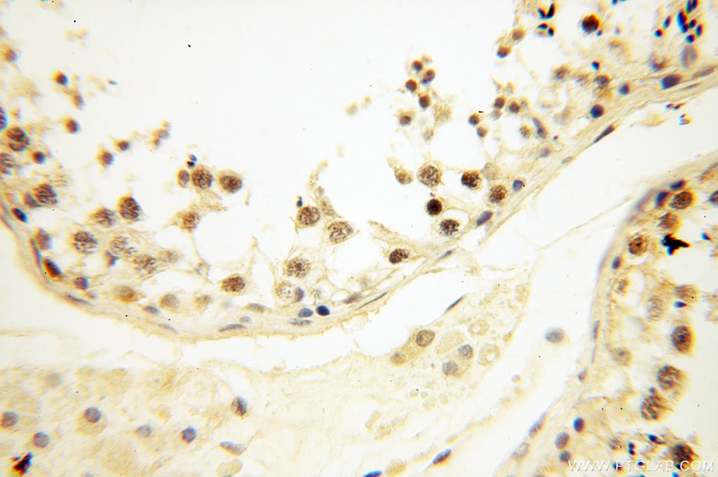 Immunohistochemistry (IHC) staining of human testis tissue using NCOA1/SRC-1 Polyclonal antibody (51114-1-AP)