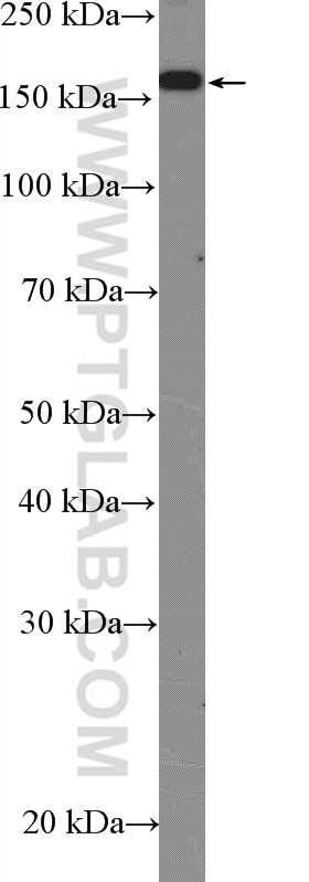 Western Blot (WB) analysis of MCF-7 cells using NCOA1/SRC-1 Polyclonal antibody (51114-1-AP)