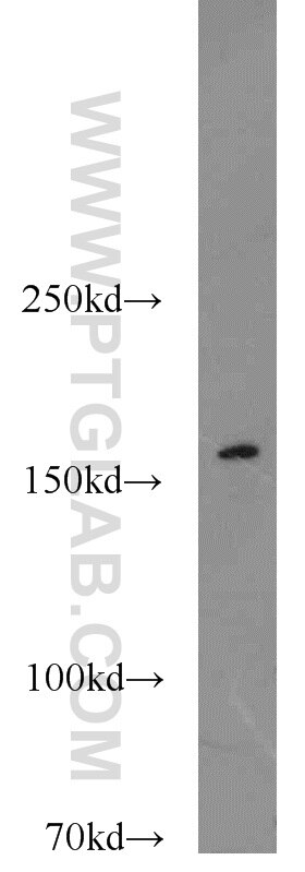 Western Blot (WB) analysis of PC-3 cells using NCOA1/SRC-1 Polyclonal antibody (51114-1-AP)