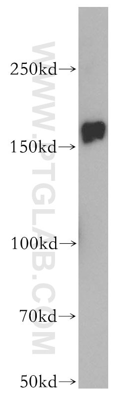 Western Blot (WB) analysis of mouse testis tissue using NCOA1/SRC-1 Polyclonal antibody (51114-1-AP)