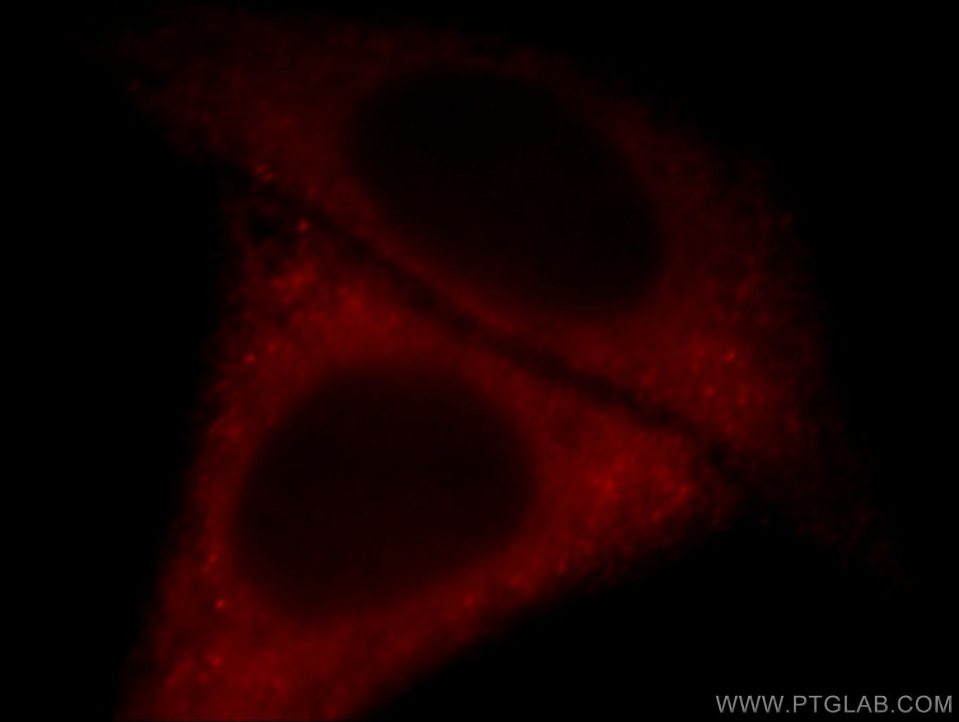 Immunofluorescence (IF) / fluorescent staining of HepG2 cells using SRC3/NCOA3 Polyclonal antibody (20032-1-AP)